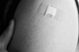 胳膊上的疤是什么疫苗？究竟有哪些疫苗会留下疤痕？